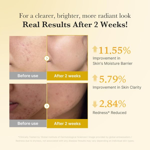 سرم روشن‌کننده کوجیک اسید و زردچوبه مدی‌کیوب  - تصویر 4