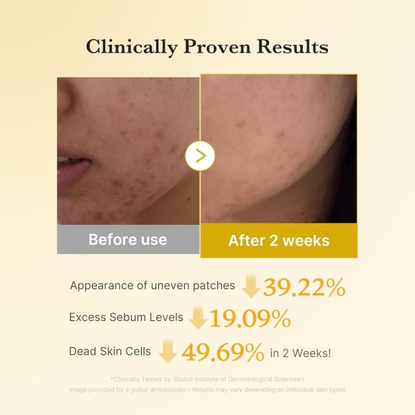 پد اسید کوجیک و زردچوبه مدی‌کیوب  - تصویر 6