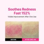 سرم ضد لک آیسوی - تصویر 5