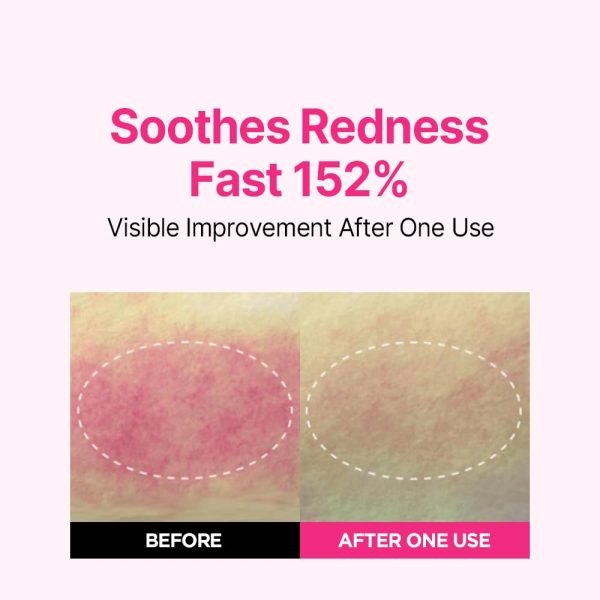 سرم ضد لک‌ آیسوی - تصویر 5