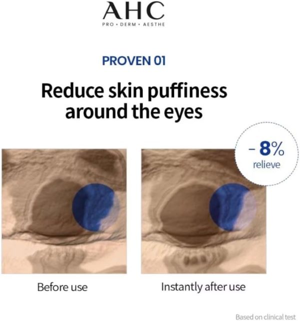 کرم  ضد چروک دور چشم و صورت پرو شات هیالورونیک حاوی 5 کپسول آ اچ سی - تصویر 5