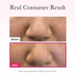 ست ماسک ژله کلاژن قرمز ارنسیا  - تصویر 8