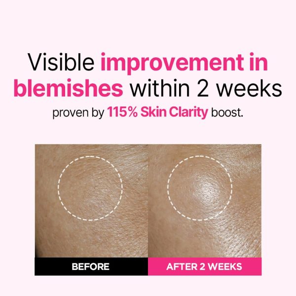 سرم ضد لک‌ آیسوی - تصویر 6