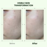 سرم درخشانکننده پروپولیس و نیاسیـنامید اوریـن - تصویر 6