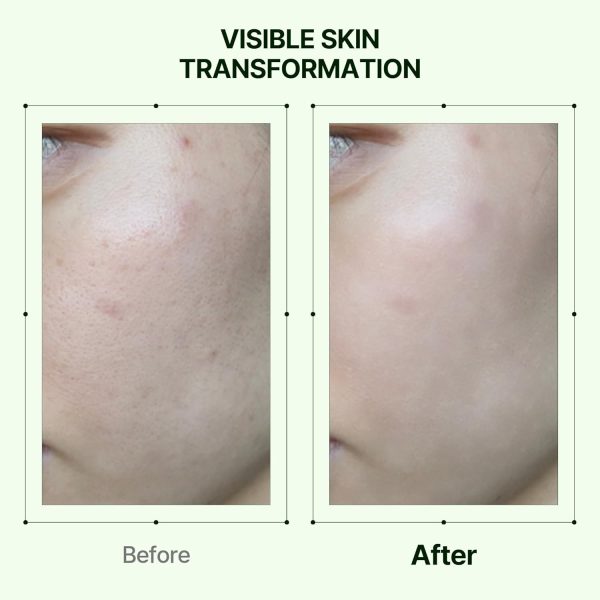 سرم درخشان‌کننده پروپولیس و نیاسیـنامید اوریـن  - تصویر 6