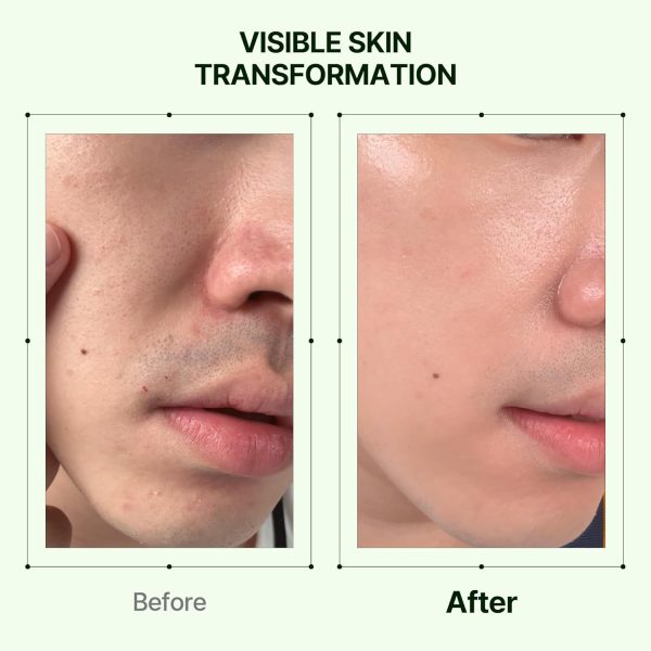 سرم منافذ کلاژن و آرتمیزیا اورین - تصویر 5